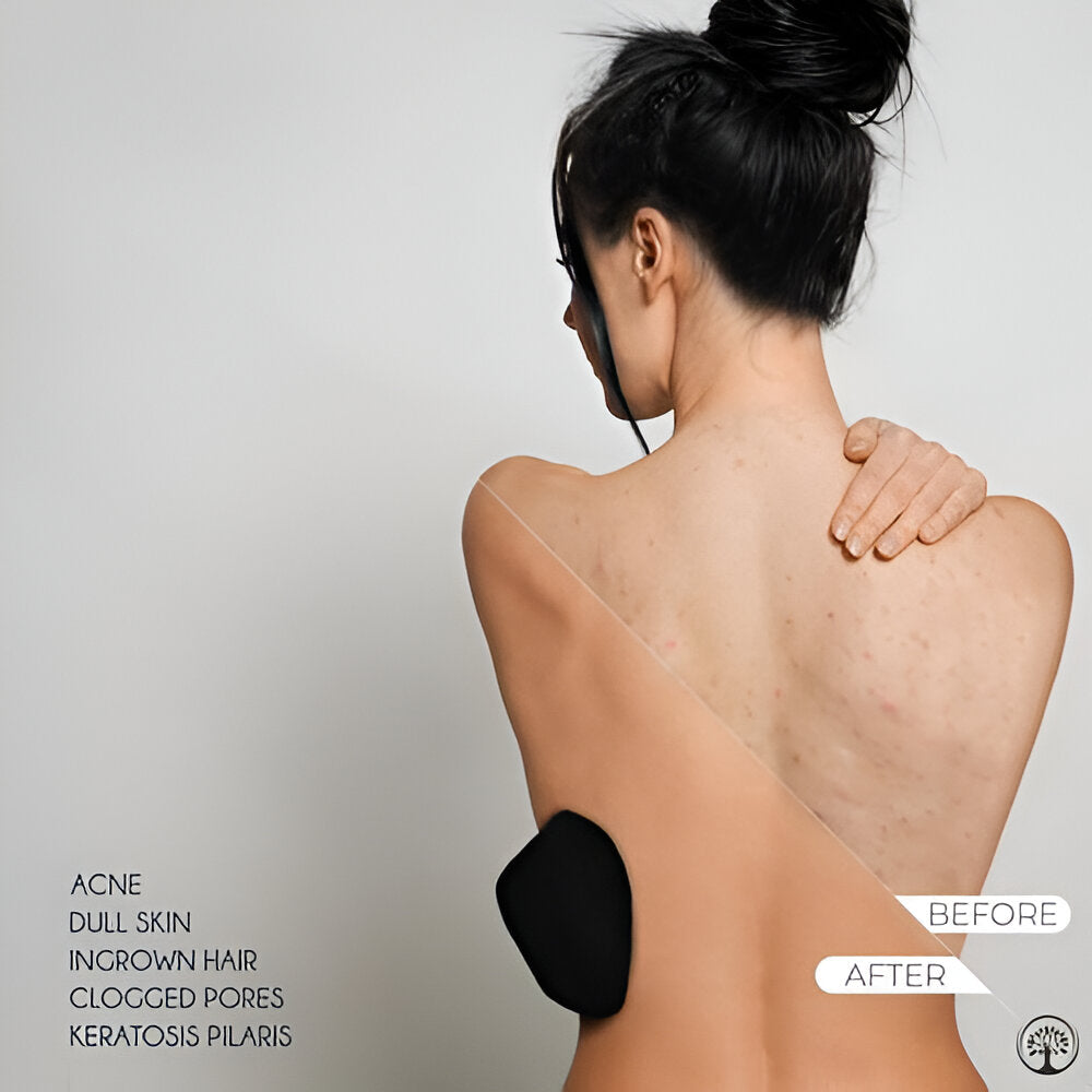 Skin Exfoliating Glove